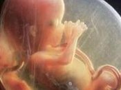 在广州做第三代试管婴儿的大概费用是多少？技术水平如何？